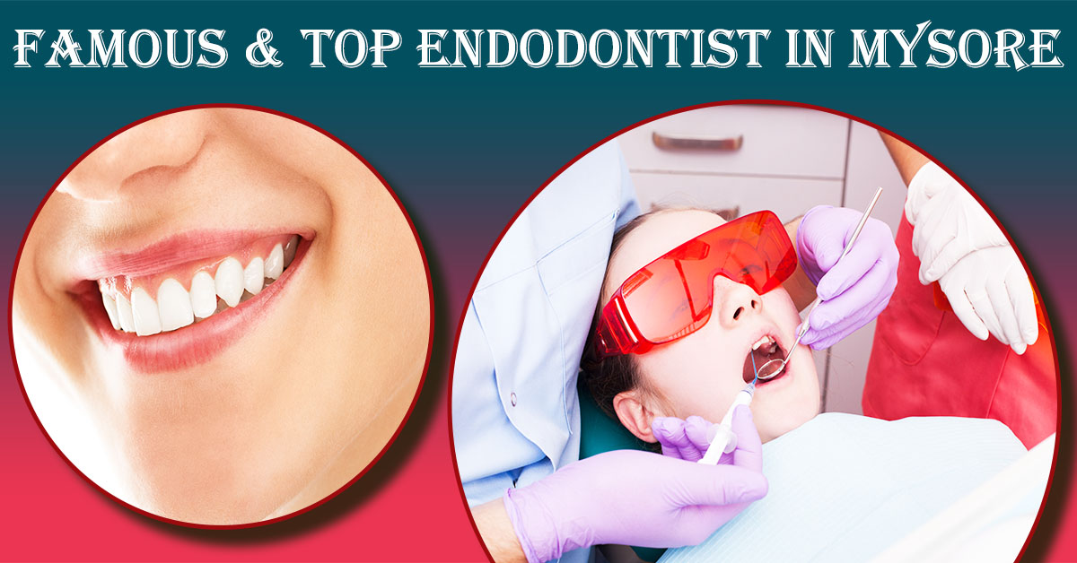 Best Endodontist in Mysore | Endodontist in Mysore