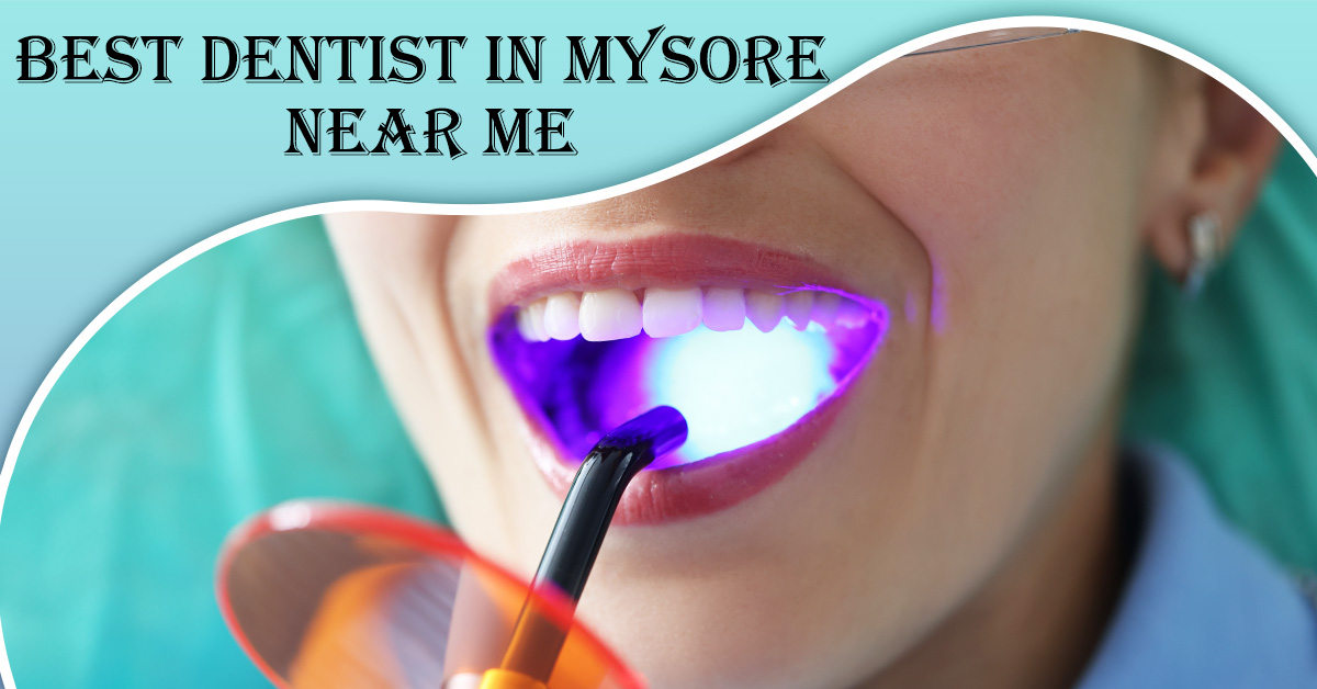 Best Dentist in Mysore | Dentist in Mysore