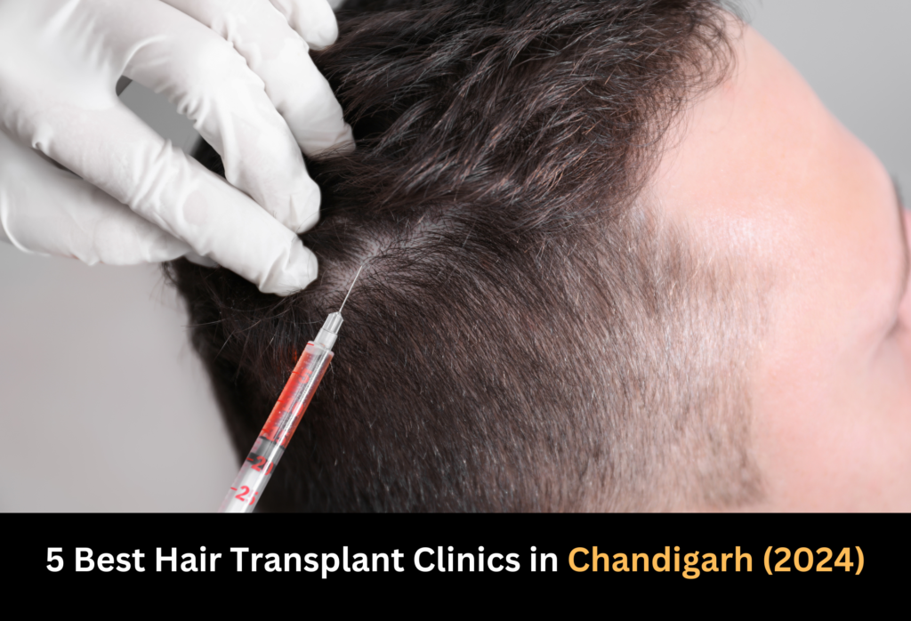 5 Best Hair Transplant Clinics in Chandigarh (2024) - VIZOX CLINIQUE